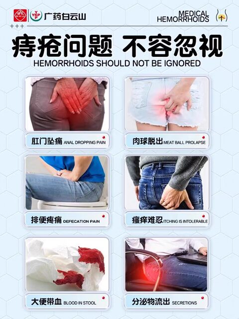 Hemorrhoid Ointment Genuine Product for Eliminating Hemorrhoids and Healing Anal Fissures for Women, Carbomer Gel Flagship Store Official