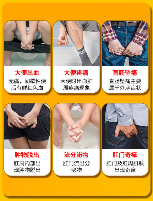 Japanese Hemorrhoid Ointment Genuine Product for Removing Hemorrhoid Lumps, Stopping Bleeding, and Healing Internal and External Hemorrhoids, Anal Fissures, and Anal Fistulas