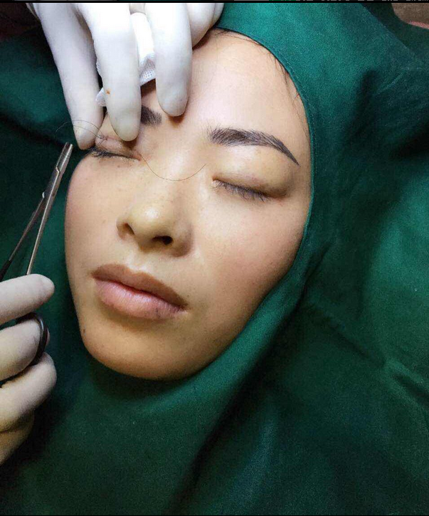 Uniforme infirmière - Ref 1861620 Image 9