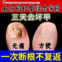 (Tongrentang hot sale) One drop will make new nails grow in seven days. Hands and toes will turn bad nails into good ones. It inhibits bacteria and does not remove nails.