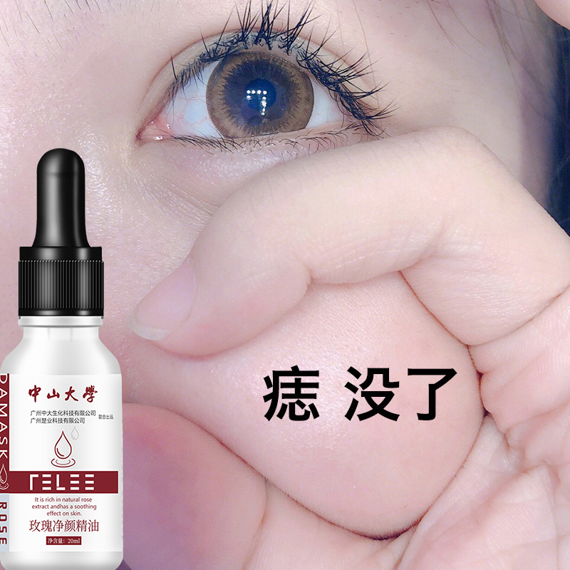 (Remove melanin from the face) Rose Essence Oil Hydrating Facial Care Freckle Removal Artifact Removes black spots from the face