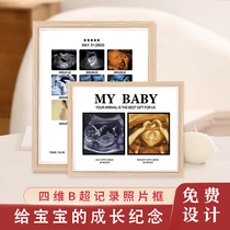 Mom’s pregnancy diary records growth photo frame small lucky pregnant child’s one-month birthday gift one-year-old gift