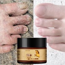 Good Things to recommend (Foogram Star Farewell to Crack) Hands And Feet Dry Crack A restore Buy 1 and 1 2 and send 3