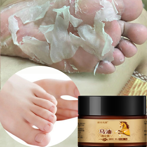 Say goodbye to foot steam Away from dryness (buy 1 free 1 Buy 2 free 3) A night with tender and smooth heels moisturizing moisturizing