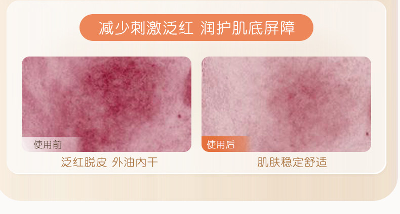 稚芽备孕洗面奶温润氨基酸表活洁面乳温润清洁保湿妇女专用护肤品 — 12