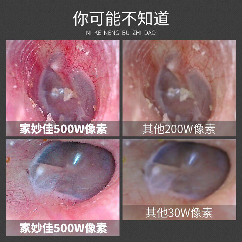 Visual Ear Mirror Dig Ear Theologer Home Medical High-definition Endoscopy With Ear Speculum Glowing Earner Earner Earner Mirror