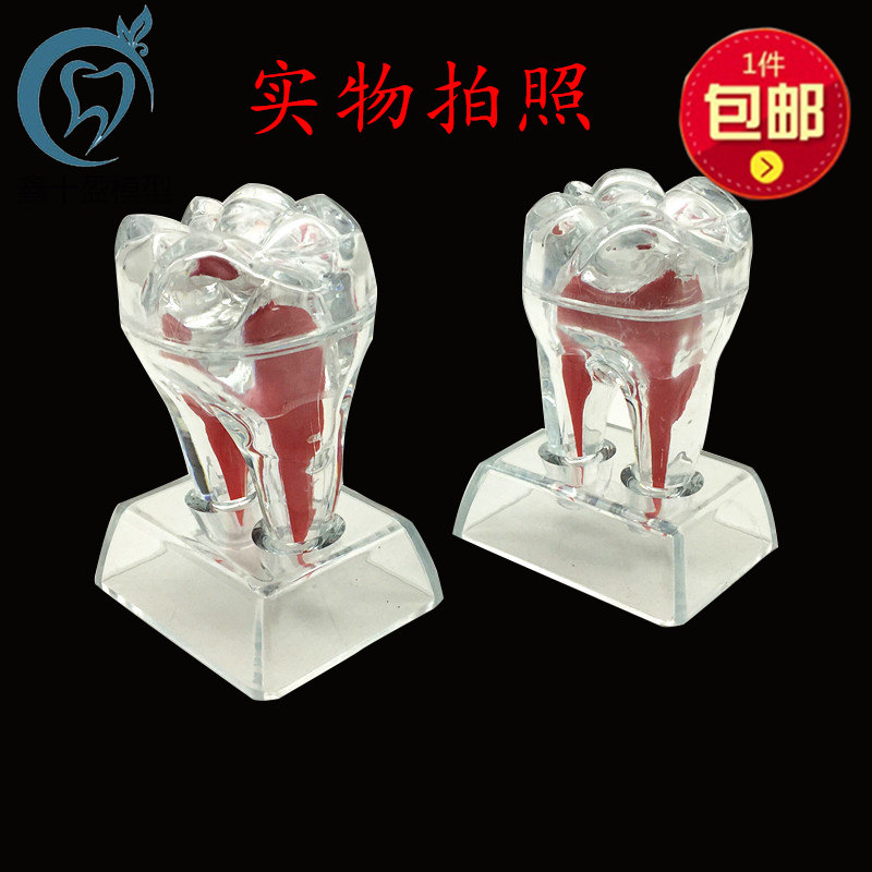 牙科可拆卸牙齿解剖模型齿科诊所牙型摆件单颗牙齿分解透明牙模型