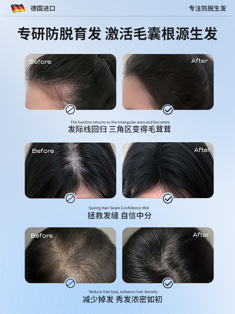 Anti-Hair Loss Shampoo, Hair Growth and Thickening, Platycladus Orientalis Leaf, Chinese Medicinal Materials, Official Flagship Store, Ranked First