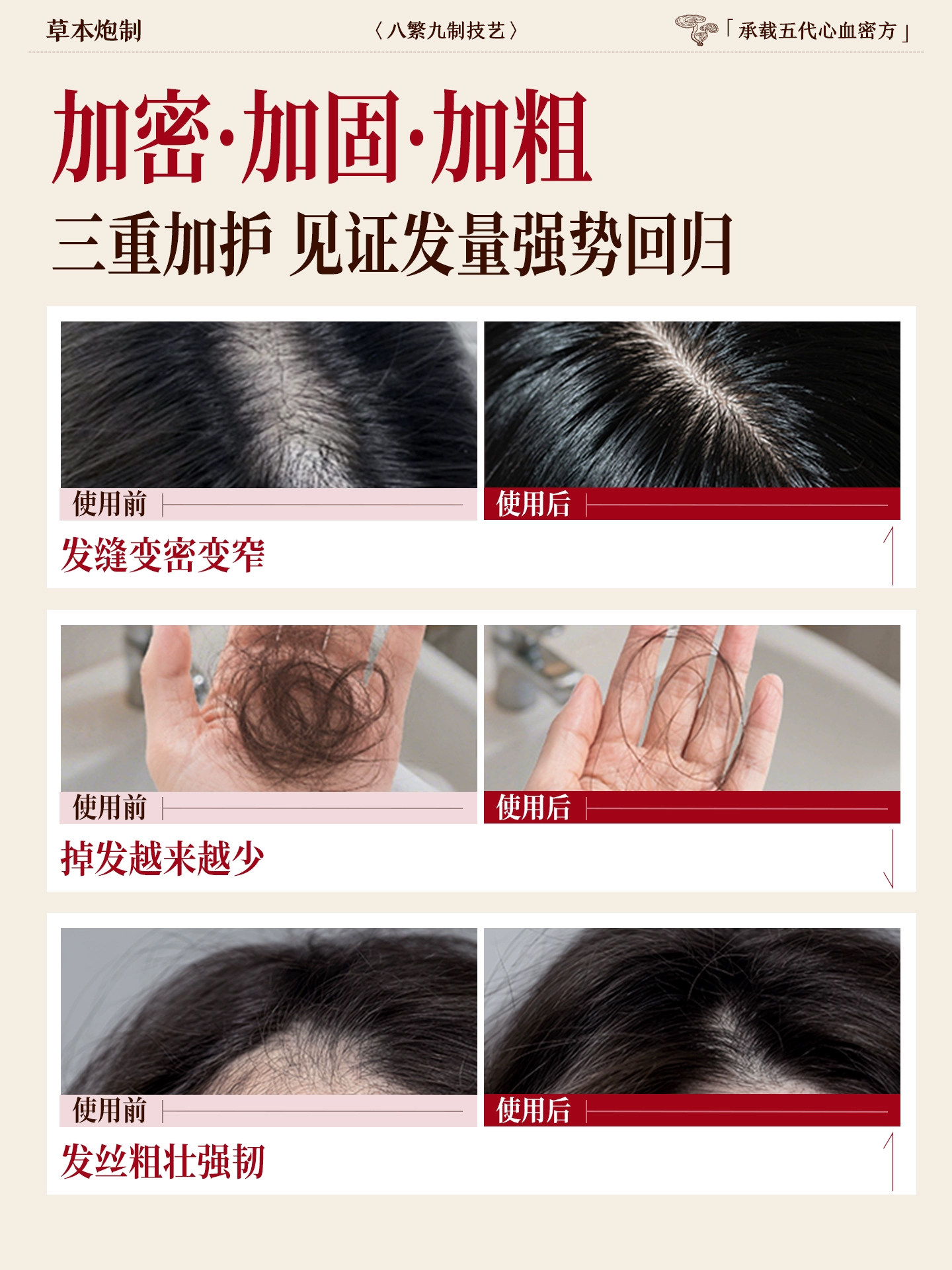 Hair Growth Serum, Hair Growth Agent, Increases Hair Density, Nourishes Hairline, Rapid Growth, Prevents Hair Loss, Nourishing Scalp Essence for Men and Women