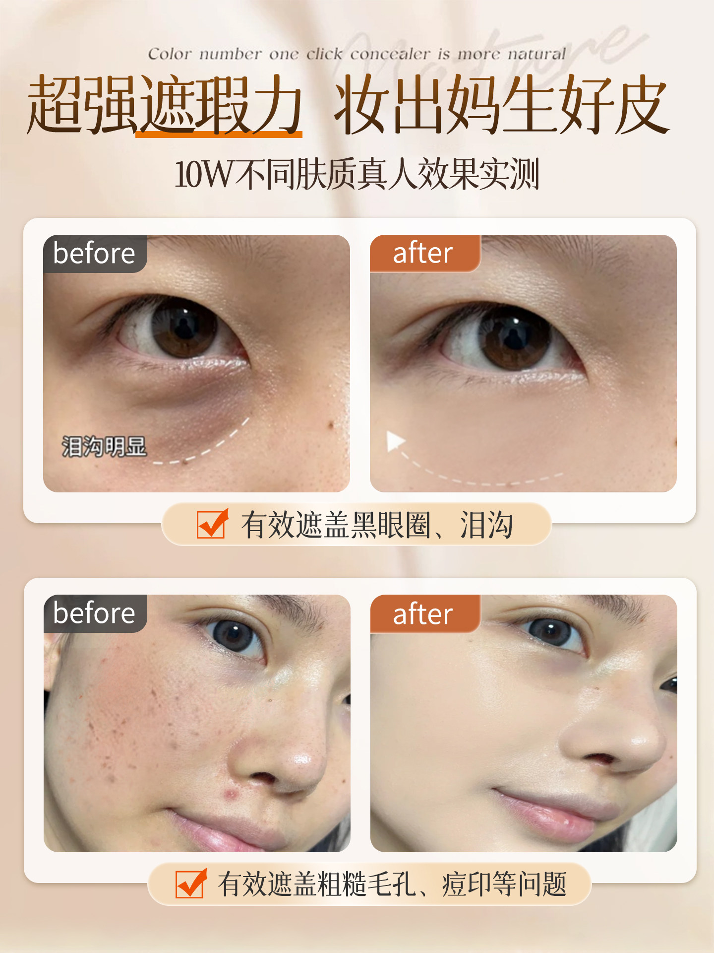 Three-Color Concealer to Cover Facial Spots, Giant Concealer Palette, Super Powerful for Dark Circles, Acne Marks, Tattoos, Specially Designed for Makeup Artists