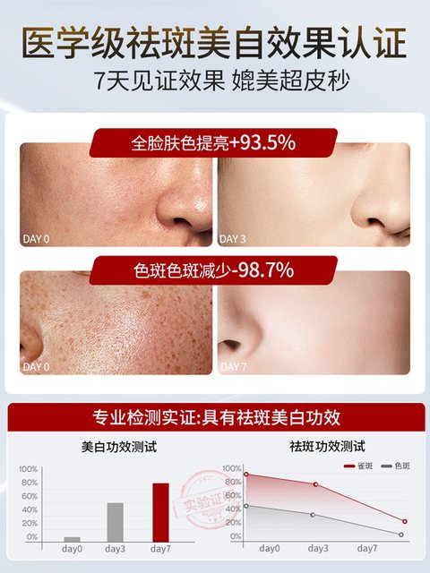 Official Flagship Store of Freckle Removal Cream, No. 1 in Authenticity, Removes Chloasma, Age Spots, Lightens Spots, Whitens and Fades Pigmentation