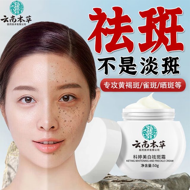 Remove Spots, Remove Chloasma and Freckles, Official Genuine Product for Removing Age Spots, Special Whitening and Lightening of Color Spots, Whitening and Freckle Removal Cream