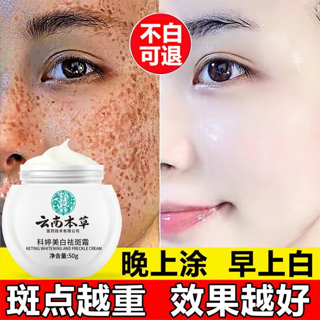 Remove Spots, Remove Chloasma and Freckles, Official Genuine Product for Removing Age Spots, Special Whitening and Lightening of Color Spots, Whitening and Freckle Removal Cream