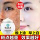 Remove Spots, Remove Chloasma and Freckles, Official Genuine Product for Removing Age Spots, Special Whitening and Lightening of Color Spots, Whitening and Freckle Removal Cream