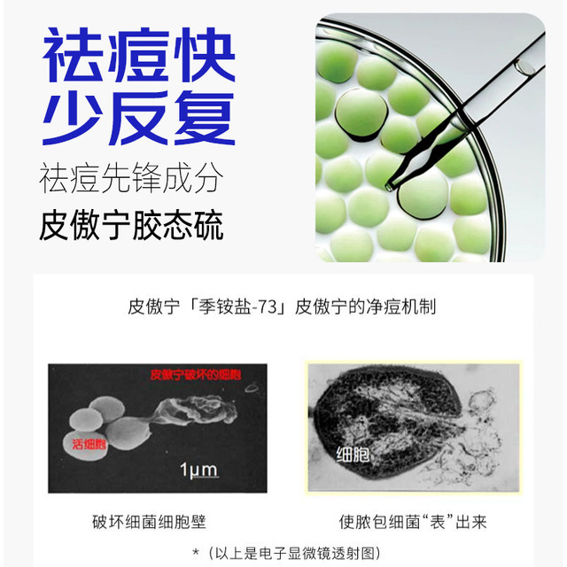 Anti-Acne Cream Official Flagship Store Genuine Anti-Acne and Lightening Acne Pits and Acne Marks Acne Azelaic Acid Anti-Acne Gel