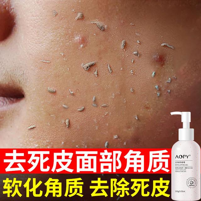 Exfoliating facial dead skin, deep cleaning, shrinking pores and blackheads, facial scrub for men and women, exfoliating dead skin gel