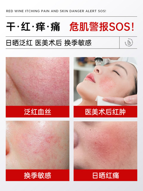 Remove Redness, Repair Sensitive Skin, Thicken the Stratum Corneum, Medical Ointment for Facial Redness, Repair Damaged Skin Barrier