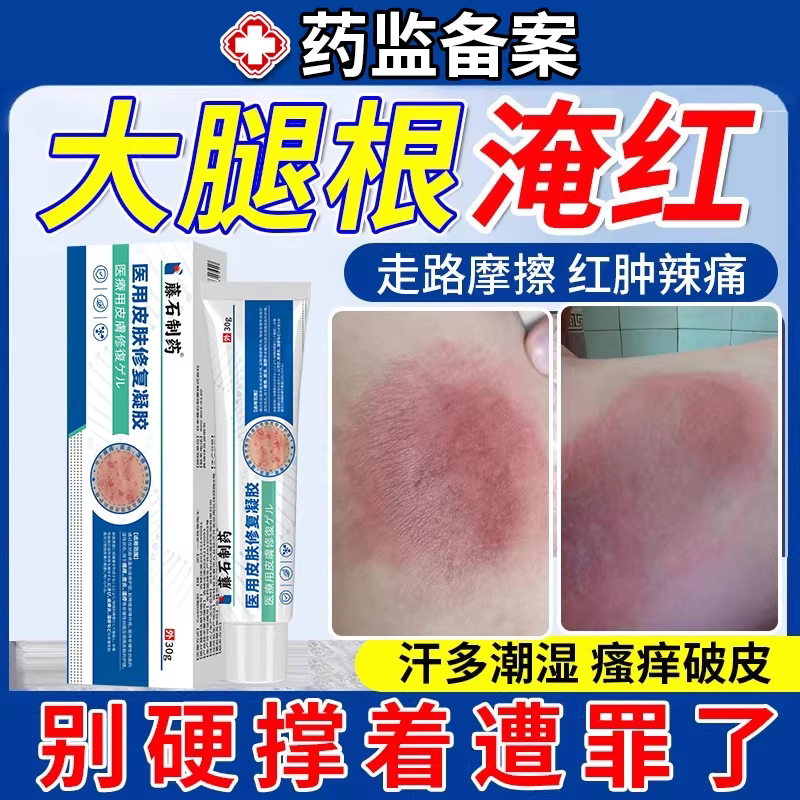 Anti-Friction Cream for the Inner Thighs to Prevent Chafing and Redness, Fda Registered, for Sweat and Friction Burns Dz Anti-Friction Cream for the Inner Thighs to Prevent Chafing and Redness, Fda Registered, for Sweat and Friction Burns Dz