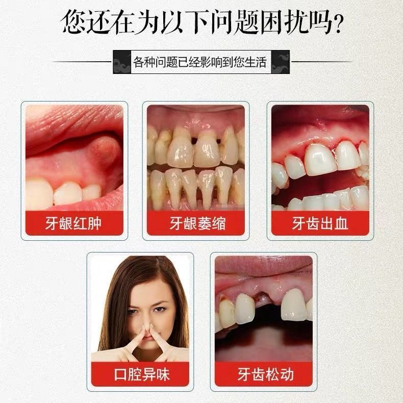 牙龈修护牙膏牙龈萎缩牙齿松动牙龈出血牙缝