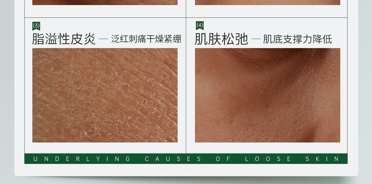 【中国直邮】EKET  医用重组人源Ⅲ型胶原蛋白皮肤修复护理膜   淡法令纹神器  【小红书强烈推荐】