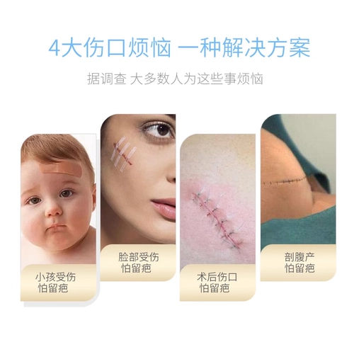 3M Скидка для швейной ленты R1547 RENTER RENT RATE RATE лента лента лента -Наклейка с гиперплазией RASCEATER R1542