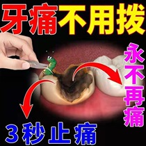Toothache anti-pain medicine quick-impact god Gingival Gingival Gingival Pain Standing can stop specializing in rotten tooth root meat Inflammation Pain Nerve