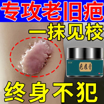 Light scar removal scar Scar Hyperplasia Raised Softening Needle Removal of the Scar Scarring Cream Official Flagship