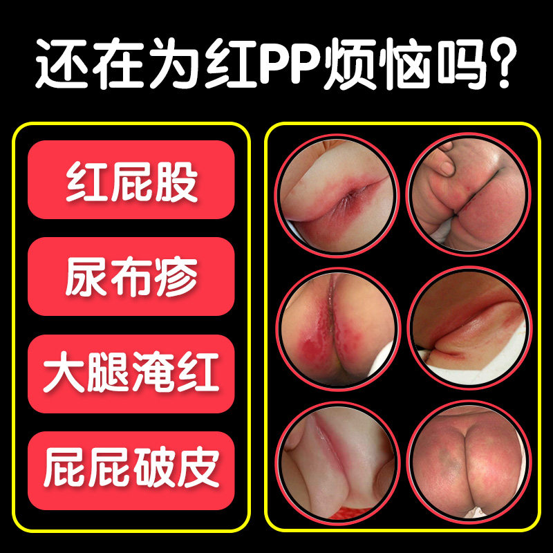 Si Tong Newborn Buttock Cream Red Butt Baby Red Ass Artifact Baby Hormone-Free Infant Rotten Skin Cream