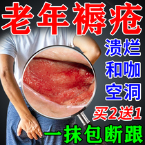 Effective decubitus ointment for the elderly buttocks external wound healing to promote fleshy skin rotten wounds bedridden myogenic ointment