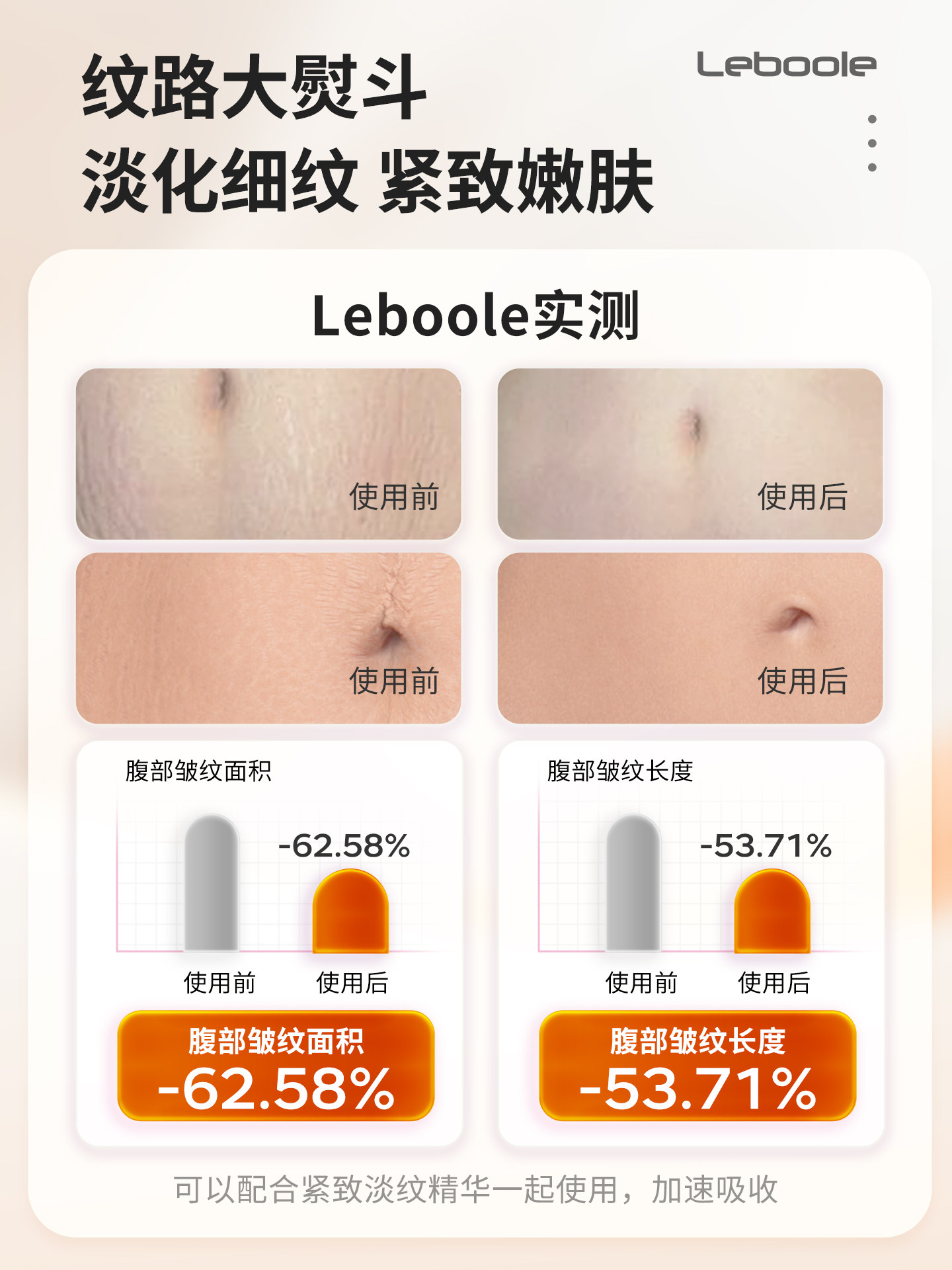 Leboole Abdominal Fitness Device Ems Weight Loss Belt, Abdominal Muscle Building, Fat Removal Machine, Pulse Fat Burning, Slim Belly Artifact