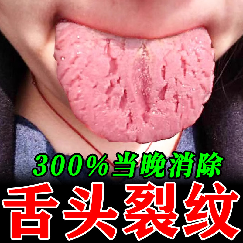 舌炎救星⚡ 东崎汉方舌焱喷雾，解决舌头开裂和炎症问题💪-口鼻清洁杀菌消炎剂-淘宝好物网