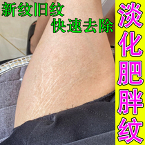 (专业修复强效淡纹)祛生长纹肥胖纹橘皮纹大腿屁股修护淡纹膏