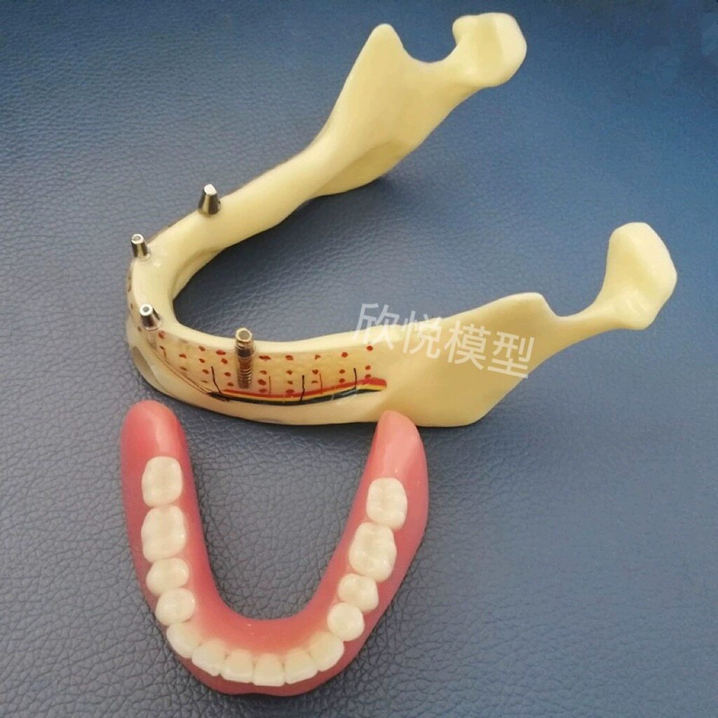 透明下颌骨模型｜让复杂的牙科知识变得“触手可及”_口腔护理设备礼盒_