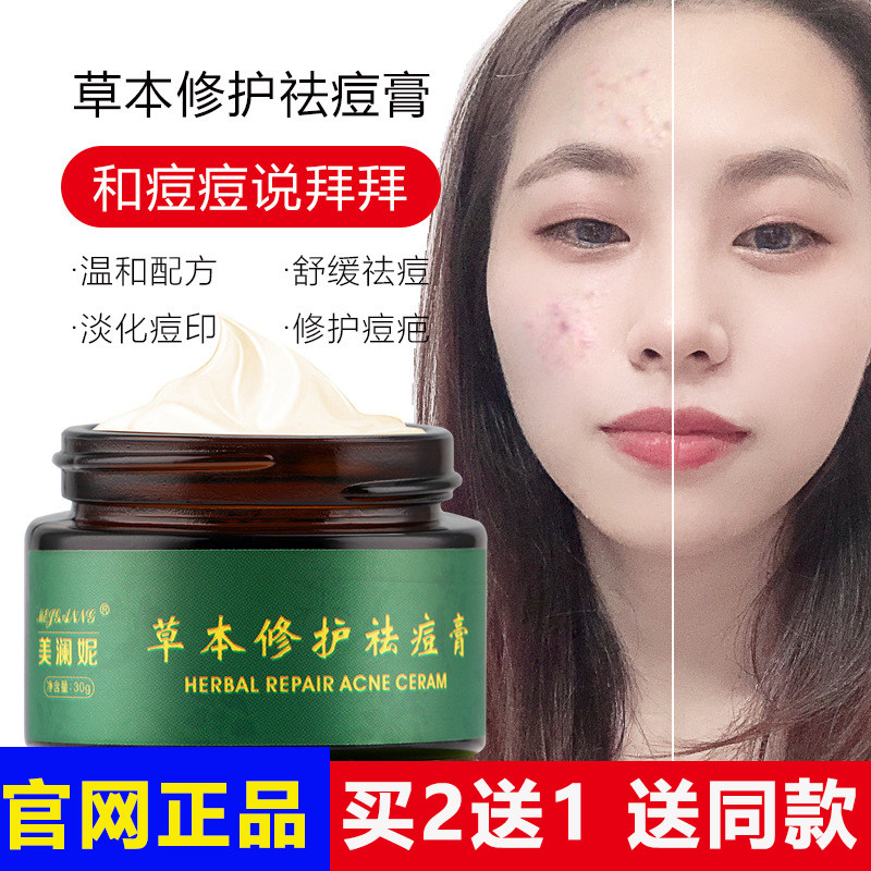 Herbal Acne Cream Moisturizing Firming Moisturizing To Shut Up Acne Blackhead Dilute Sensitive Acne Print Cream Shrink Pores