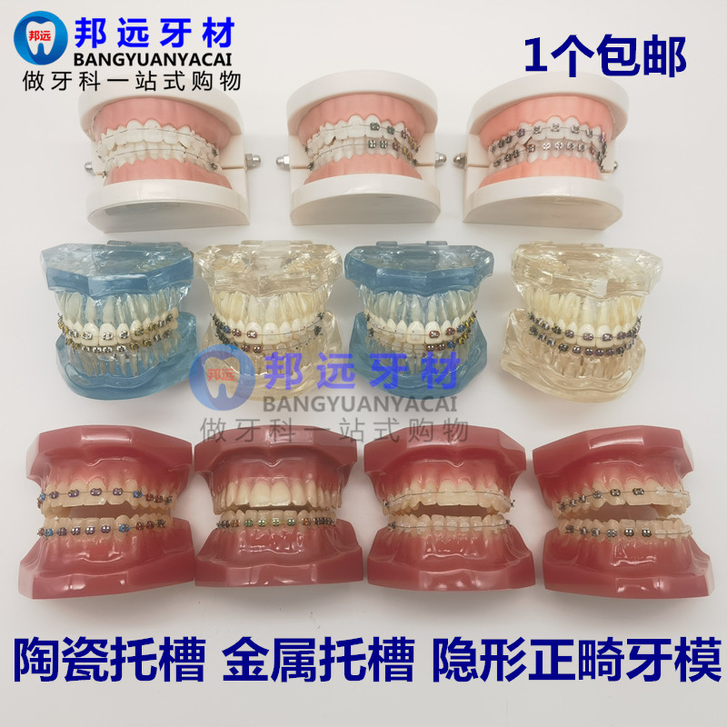 牙科正畸模型 透明错颌矫正展示模型 结扎丝托槽正畸隐形正畸模型