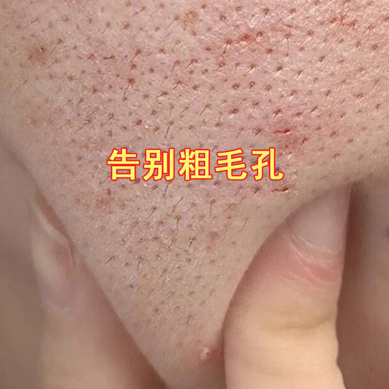 (Weiya direct sowing room) levo-lactose acid shrink pores essence warps moisturizing moisturizing and moisturizing men and women to buy 2 sends 1