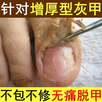 Drop a drop of antibacterial without removing 99 % gray potassium fungus invalid