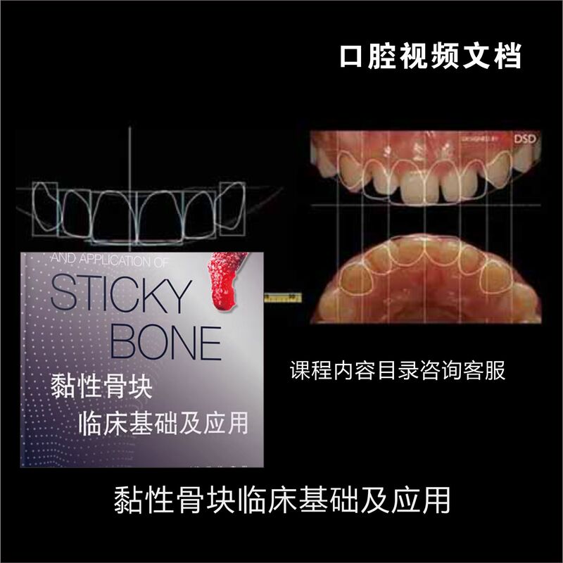 Clinical Basis and Applications of Adhesive Bone Grafts Electronic Material