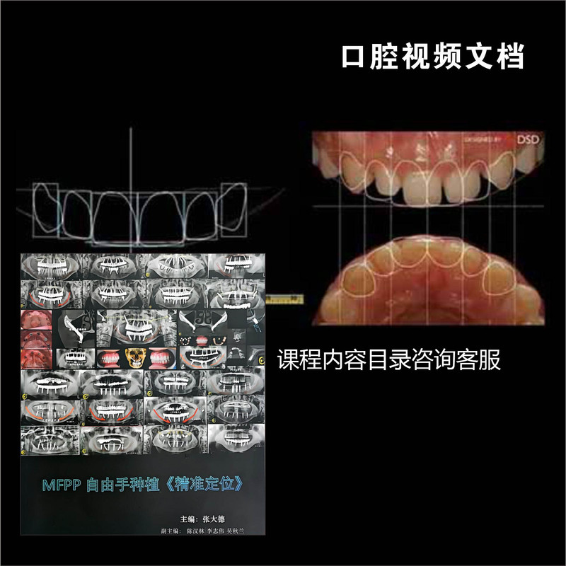 Mfpp Free-Hand Planting Precise Positioning Electronic Materials