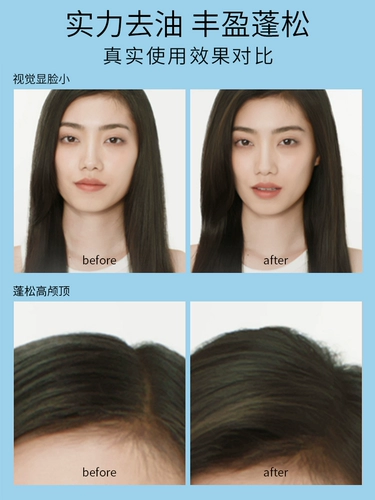 L'Oreal, шампунь, успокаивающая маска для волос, придает объем, контроль жирного блеска