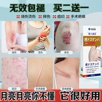 Scar removal cream to remove scars repair pimple marks abrasions oil burns scar removal scar ointment to remove hyperplasia and bulges