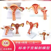 Female Reproductive Modeler Model Womb Model Skeletal Basin Model Anatomical Model Ovarian Pathology Change Pelvis Teaching