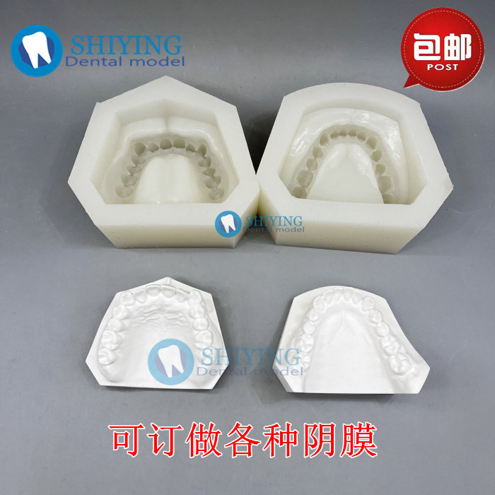 牙科错颌正畸阴模 翻制安氏错颌石膏牙列模型 软硅胶模具订制包邮