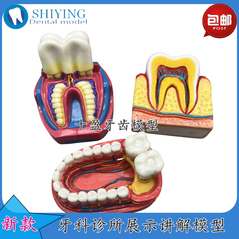 牙齿摆件 口腔模型摆件 医患沟通 牙科模型模具 口腔诊所讲解摆台