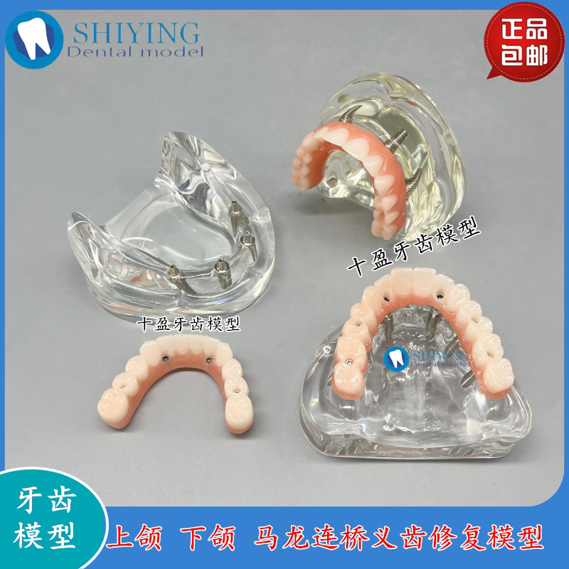 牙科口腔模型马龙连桥义齿种植修复模型教学练习仿真演示交流模型
