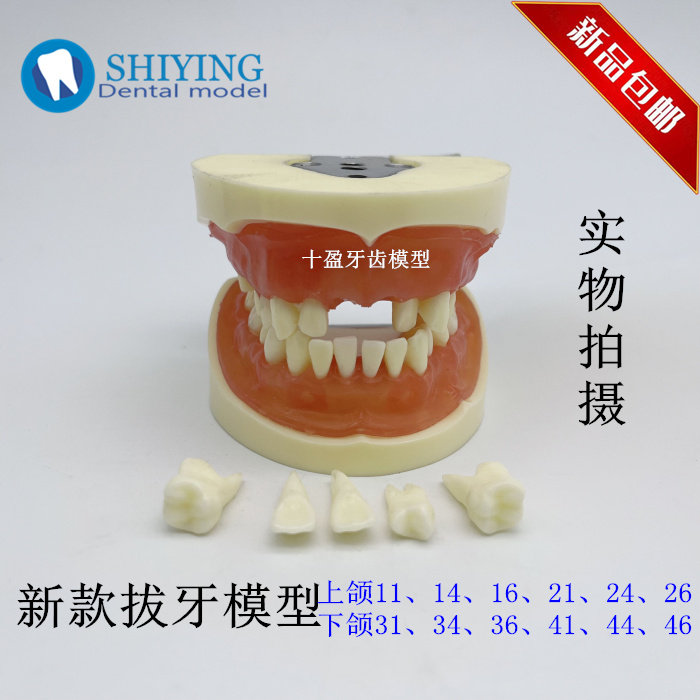 牙科口腔教学可拔牙软牙龈树脂牙齿 医患沟通练习带牙根 错颌模型
