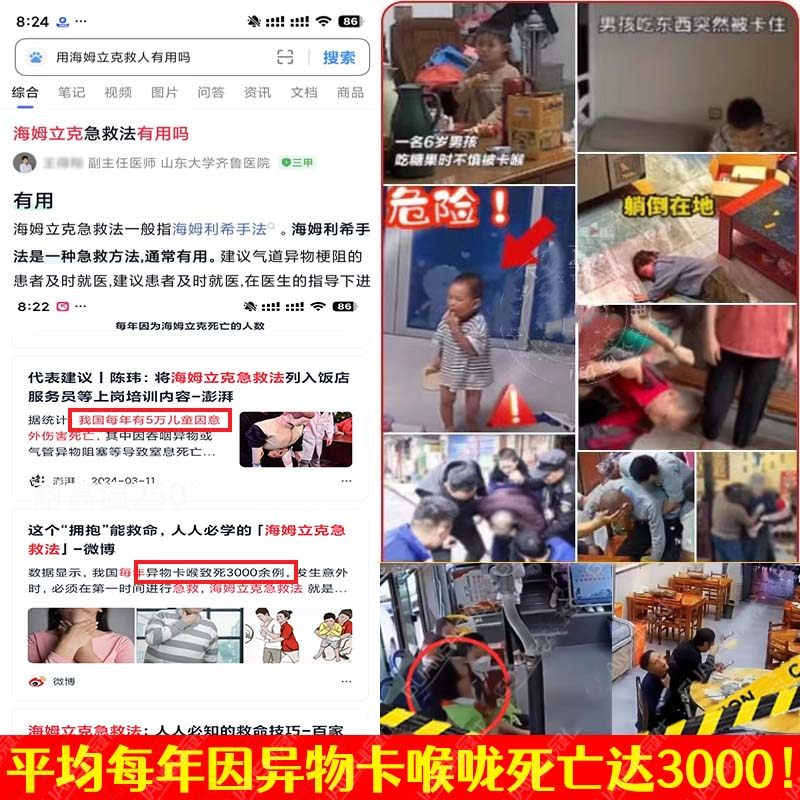 Heimlich Anti-Choking Device Official Genuine First Aid Device Anti-Suffocation Emergency Suction Device Children's Breathing Mask Anti-Choking