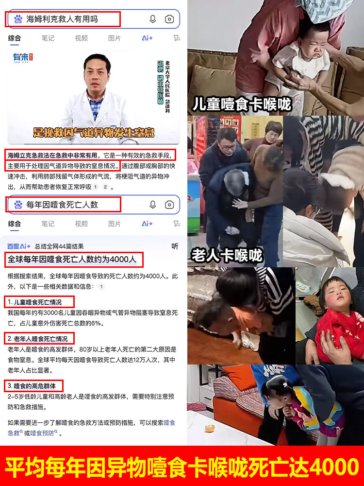 Heimlich First Aid Device Anti-Choking Device Official Genuine Baby Anti-Suffocation First Aid Respirator for Choking Milk Family Portable