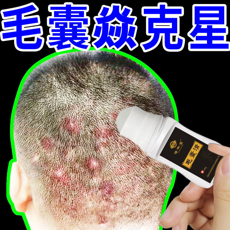 Treatment of scalp hair follicle inflammation artifact head acne head on the front chest and back long pimples special medicine for acne and mite removal