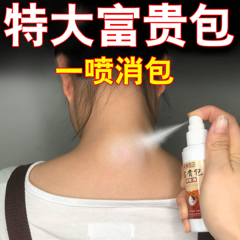 Rich and expensive bag elimination of neck neck dredging massager cervical spine shoulder large vertebral cavity drum kit elimination deviner